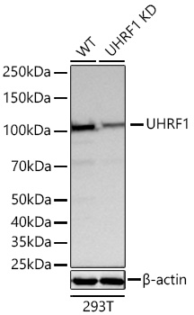 UHRF1 Monoclonal Antibody [5D5N5]&nbsp;<img src="images/icon_newarrival.gif" alt="new" border="0">