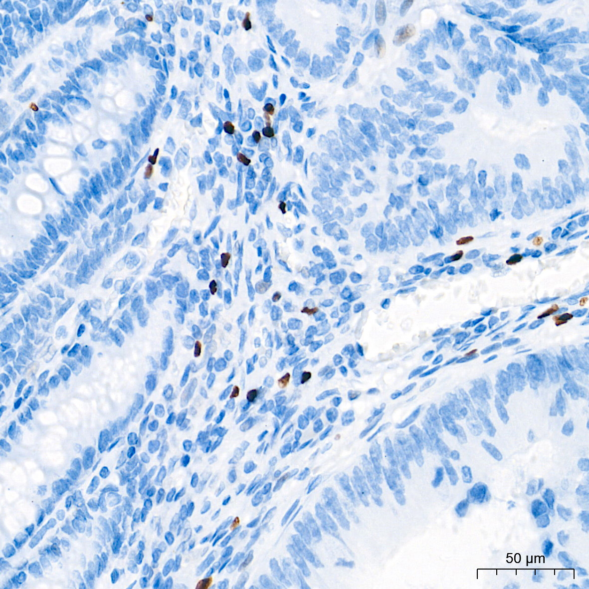 FOXP3 Monoclonal Antibody [8C4R7]