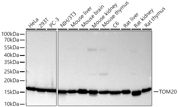 TOM20 Monoclonal Antibody [1B0I4]