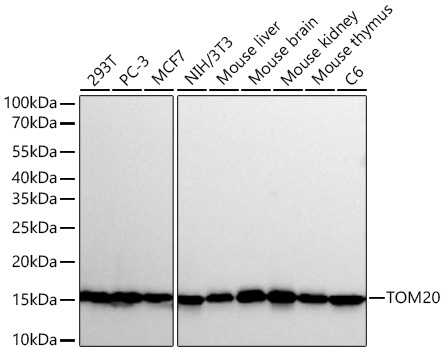 TOM20 Monoclonal Antibody [1W0Y7]