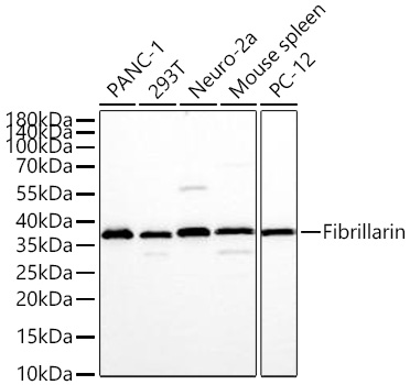 Fibrillarin Monoclonal Antibody [1R7D8]