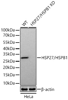HSP27/HSPB1 Monoclonal Antibody [4L2K1]&nbsp;<img src="images/icon_newarrival.gif" alt="new" border="0">