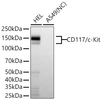CD117/c-Kit Monoclonal Antibody [0Q6R2]