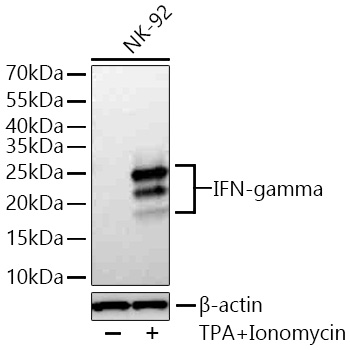 IFN-gamma Monoclonal Antibody [3Z4N2]