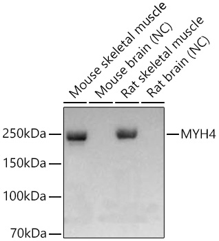 MYH4 Monoclonal Antibody [1X3S1]