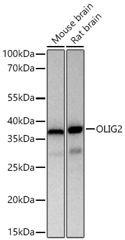 OLIG2 Monoclonal Antibody [5M4S9]
