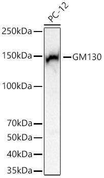 GM130 Monoclonal Antibody [5M9E7]