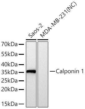 Calponin 1 Monoclonal Antibody [5J9K5]