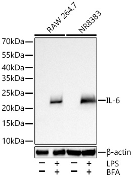 IL-6 Monoclonal Antibody [8X8X7]
