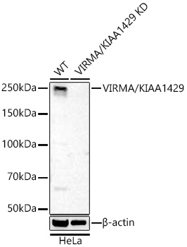 VIRMA/KIAA1429 Monoclonal Antibody [4S4O5]&nbsp;<img src="images/icon_newarrival.gif" alt="new" border="0">