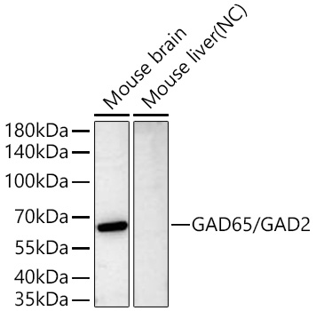 GAD65/GAD2 Monoclonal Antibody [5Y9K1]