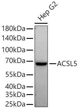 ACSL5 Monoclonal Antibody [7O6D9]&nbsp;<img src="images/icon_newarrival.gif" alt="new" border="0">