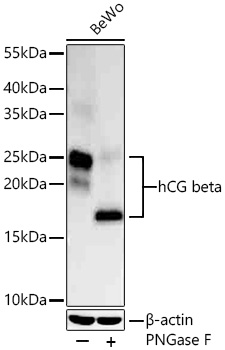 hCG beta Monoclonal Antibody [9V5Z2]