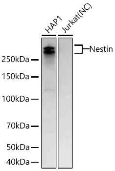Nestin Monoclonal Antibody [1Z2V0]