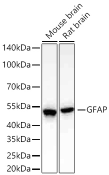 GFAP Monoclonal Antibody [6C8B1]