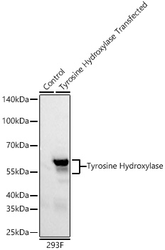 Tyrosine Hydroxylase Monoclonal Antibody [5V10Q6]
