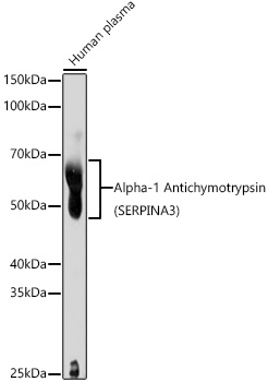 Alpha-1 Antichymotrypsin (SERPINA3) Polyclonal Antibody