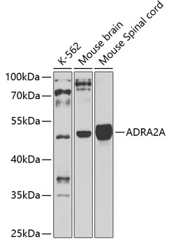 ADRA2A Polyclonal Antibody&nbsp;<img src="images/icon_newarrival.gif" alt="new" border="0">