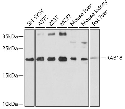 RAB18 Polyclonal Antibody