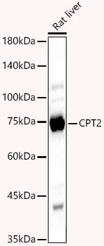 CPT2 Polyclonal Antibody