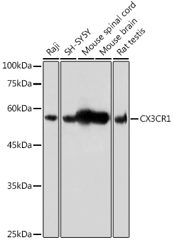 CX3CR1 Polyclonal Antibody