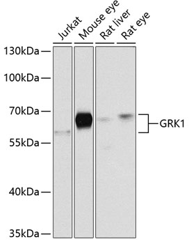 GRK1 Polyclonal Antibody