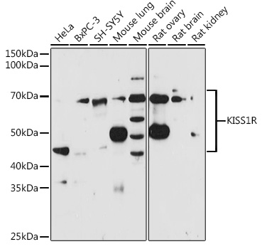KISS1R Polyclonal Antibody