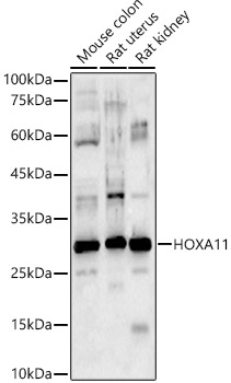HOXA11 Polyclonal Antibody