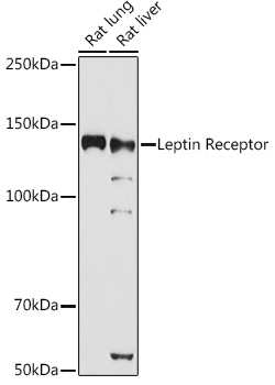 Leptin Receptor Polyclonal Antibody