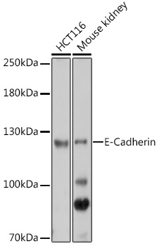 E-Cadherin Polyclonal Antibody