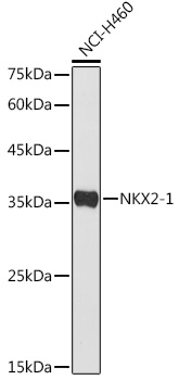 NKX2-1 Polyclonal Antibody