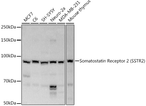 Somatostatin Receptor 2 (SSTR2) Polyclonal Antibody
