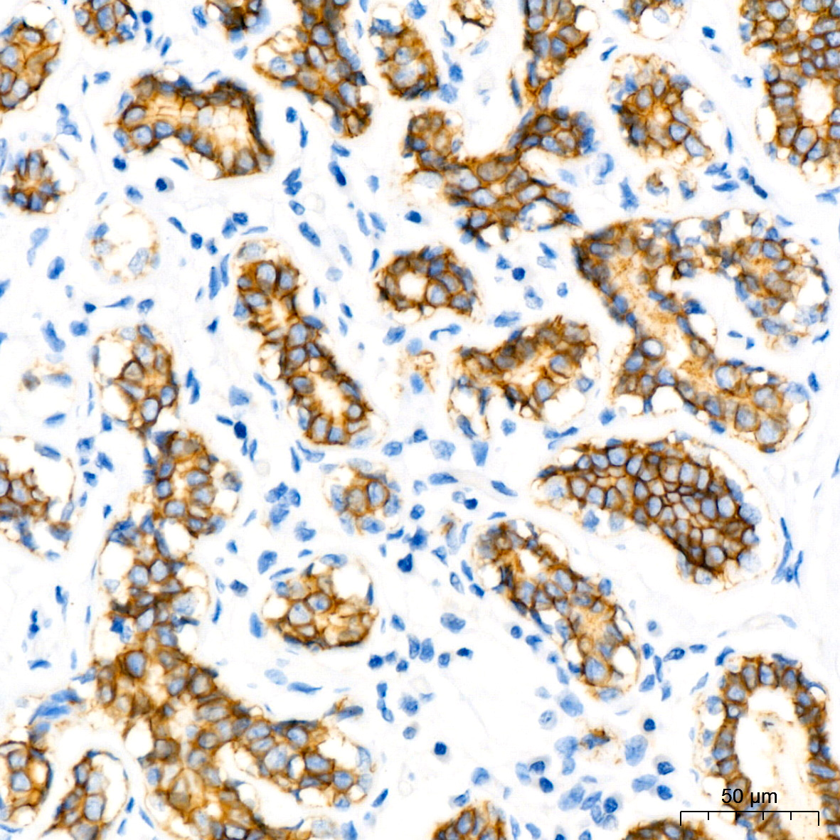 E-Cadherin Monoclonal Antibody