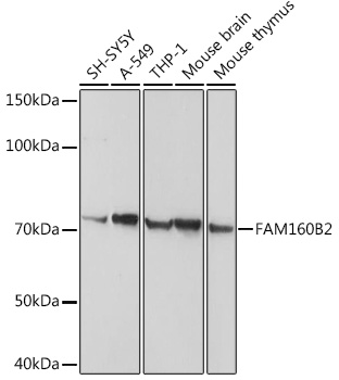 FAM160B2 Polyclonal Antibody