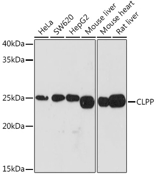 CLPP Monoclonal Antibody [1W6O4]
