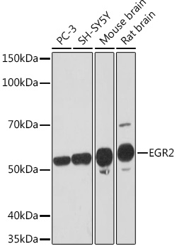 EGR2 Monoclonal Antibody [1F6V7]