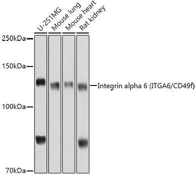 Integrin alpha 6 (ITGA6/CD49f) Polyclonal Antibody