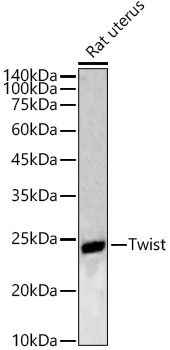 Twist Polyclonal Antibody
