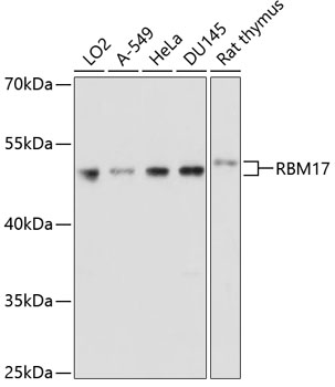 RBM17 Polyclonal Antibody