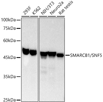 SMARCB1/SNF5 Monoclonal Antibody [9A9G0]
