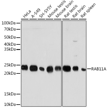 RAB11A Monoclonal Antibody [3O4R8]
