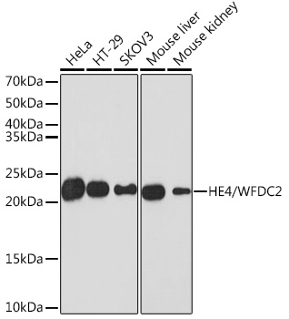 HE4/WFDC2 Monoclonal Antibody [6K2F5]