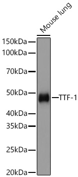 TTF-1 Monoclonal Antibody [3O2N3]