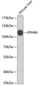 EPHB4 Polyclonal Antibody