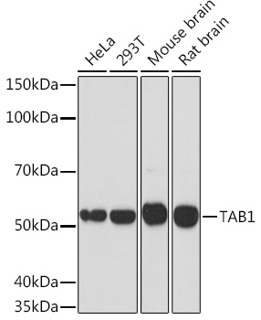 TAB1 Monoclonal Antibody [2W0P2]