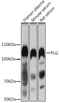 PLG Polyclonal Antibody
