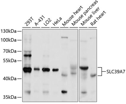 SLC39A7 Polyclonal Antibody
