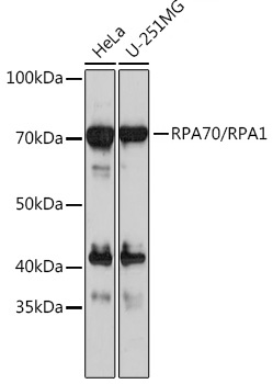 RPA70/RPA1 Monoclonal Antibody [5R7S3]