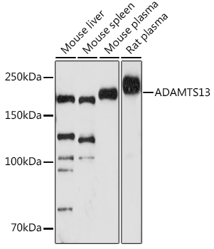 ADAMTS13 Monoclonal Antibody [7B2Z8]&nbsp;<img src="images/icon_newarrival.gif" alt="new" border="0">