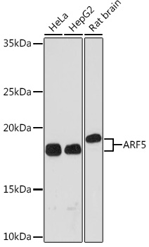 ARF5 Monoclonal Antibody [0U0D2]